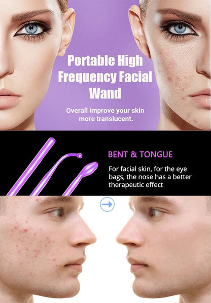 Handheld Skin Tightening Beauty Therapy